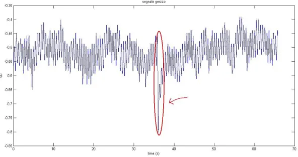 Fig. 2.3: Segnale grezzo di ampiezza verticale dello spostamento (VD) in funzione del tempo