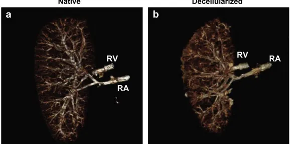 Figura 3.3:  Confronto della rete vascolare tra un rene nativo (a) e uno decellularizzato  (b) [1]