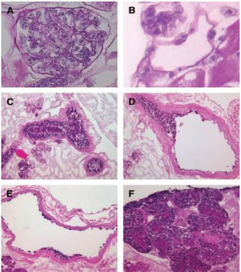 Figura  3.8:  Morfologie  distinte  di  ESCs  coltivate  in  uno  scaffold  renale  decellularizzato  [3]