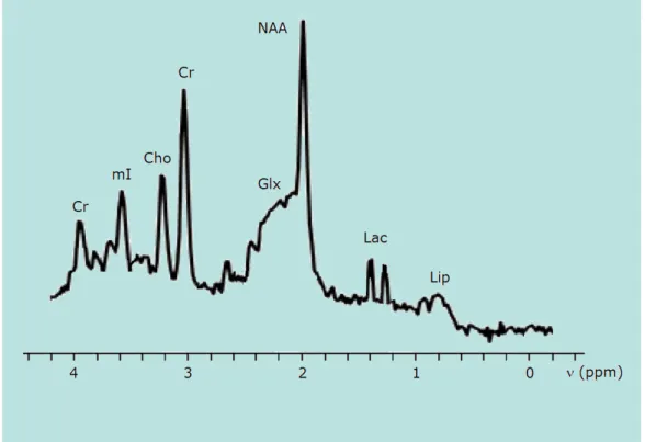 Figure 2.1: In vivo proton spectrum of the main metabolites with frequency range of 4 ppm.