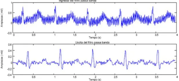 Figura 2.1: Segnale contaminato dal rumore (in alto), segnale filtrato (in basso) 
