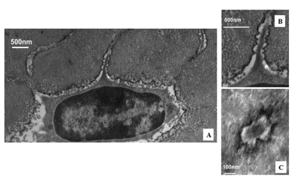 Fig. 4. TEM photomicrograph of osteoctye (A) shows osteocyte and enlarged longitudinal (B) and cross-sections (C) of cell process showing that the bony wall of the canaliculus has protrusions  projec-ting from the wall completely across the pericellular sp