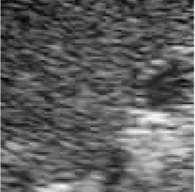 Figura  8.  Le  immagini  ecografiche  sono  caratterizzate  da  una  granulosità  caratteristica,  detta  speckle,  fortemente  correlata  con  la  struttura  a  cui  si  sovrappone