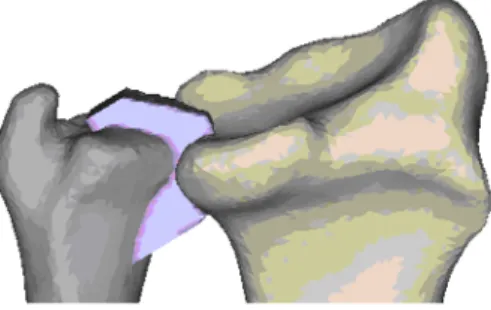 Figure 19. Cartilage 3D object, as much as possible similar to the anatomical Cartilage&#34;