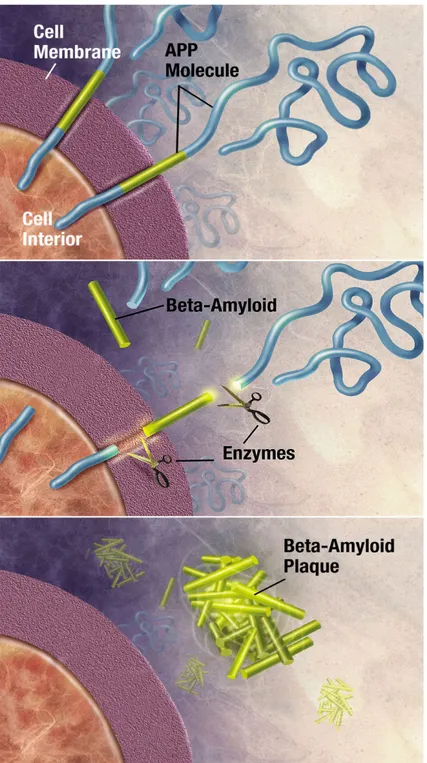 Figure 3.2: Formation of Beta-Amyloid plaques