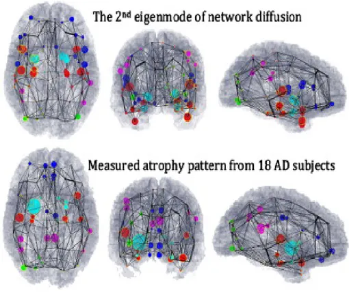 Figure 4.2: Visual corrispondence between theoretical prediction and mea- mea-sured Alzheimer’s atrophy patterns: Wire-and-ball plot represent whole brain atrophy patterns, where each brain region of interest is depicted as a ball whose size is proportiona