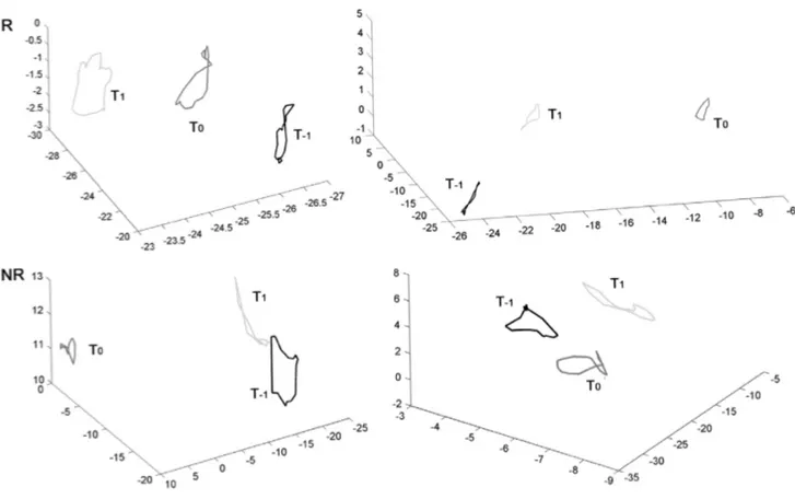 Fig. 2.6- Andamento generale della traiettoria 3D nei tre tempi.