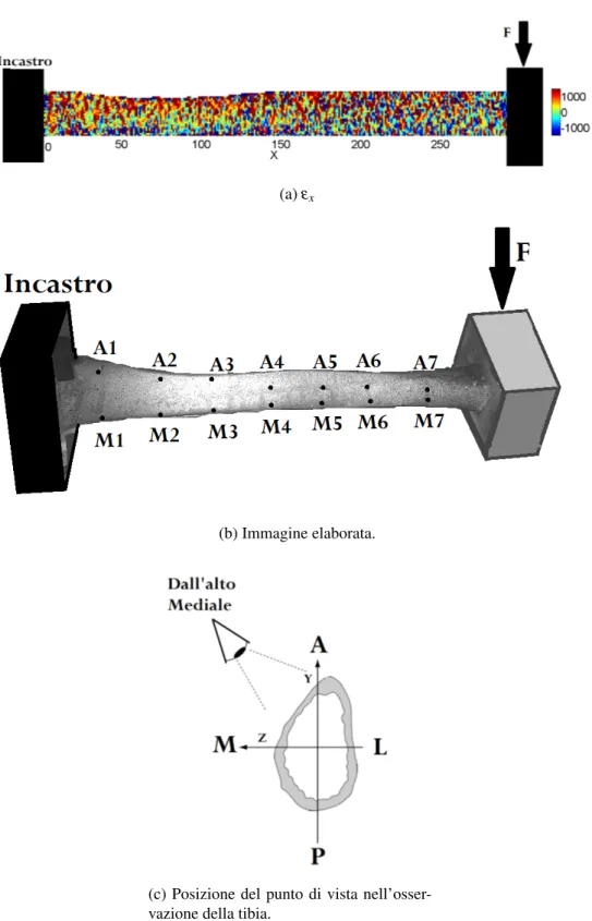 Figura 4.32: Osservazione dall’alto dal lato del mediale, flessione a sbalzo P-A a spostamento imposto massimo.