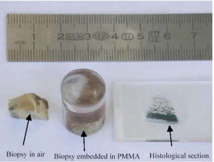 Figure 1.6: Bone biopsy and preparation of the histological observation pro- pro-cedure.