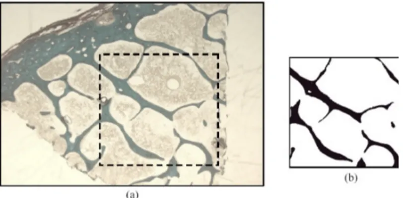 Figure 1.7: (a) Histological section of a bone sample containing both cortical and cancellous bone