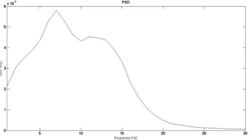 Figura 12. Attività del TRN e del TCN durante la fase 1 del sonno (onde theta). 