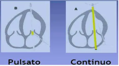 Figura  1.8  Fascio  ultrasonico  attraverso  il  cuore:A:  nel  Doppler  continuo  il  trasduttore  è  costituito  da  due  cristalli  (uno  invia  e  l’altro  riceve  gli  impulsi),  che  trasmettono  e  ricevono  continuamente