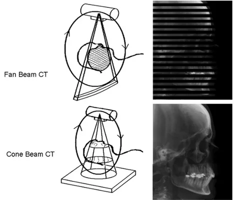 Figura 2.6: confronto fan-beam CT e cone-beam CT