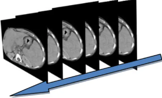 Figura 3: esempio sequenza immagini CT