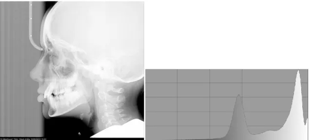 Figura 2-2-1.a. Immagine CEPH con DG uguale ad uno.     Figura 2-1.b  Istogramma dell’immagine CEPH con DG ad 1 