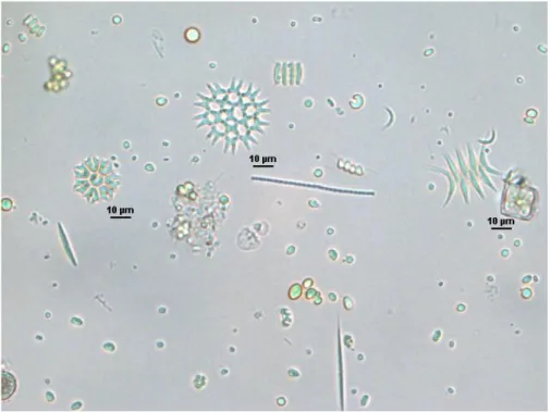 Figura  3.4  Immagine  al  microscopio  ottico  con  un  ingrandimento  32X  della  popolazione di microalghe e cianobatteri