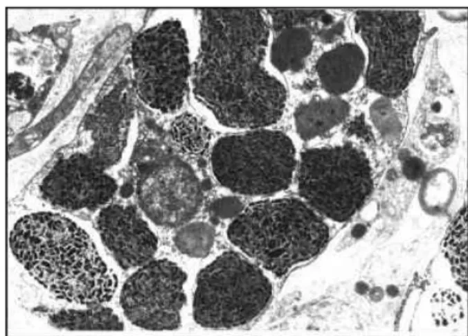 Figura  2.4 Cellula sferulosa fotografata al TEM. 