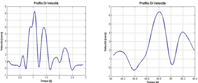 FIG. 8 – Andamento dei profili di velocità in un momento intermedio della terapia [sinistra] e nella fase finale del trattamento [destra] per uno dei pazienti inseriti nello studio.