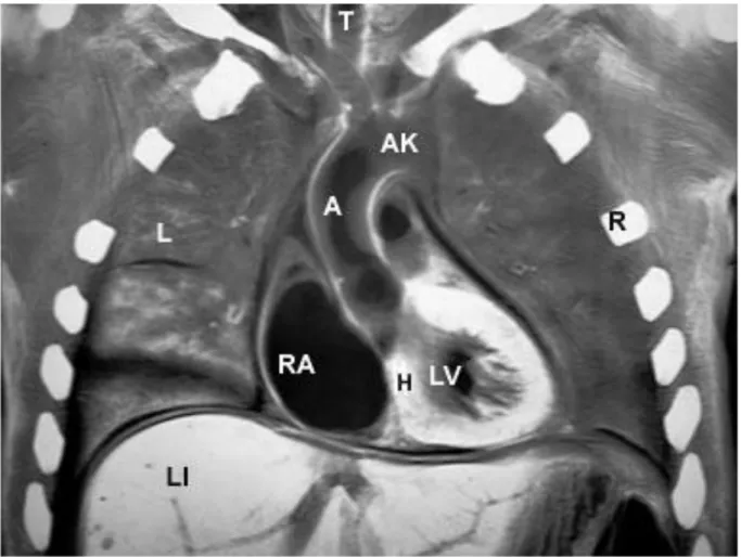 Fig. 1.10: risonanza magnetica cardiaca. Immagine tratta da [ 14]. 