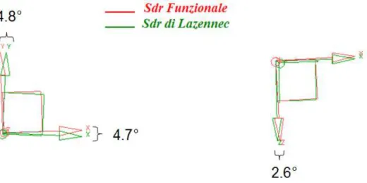 Figura 2.15: Differenza tra Sistema &#34;Funzionale&#34; e &#34;di Lazennec&#34; in una vista laterale  (a sinistra) e in una vista dall’alto (a destra)