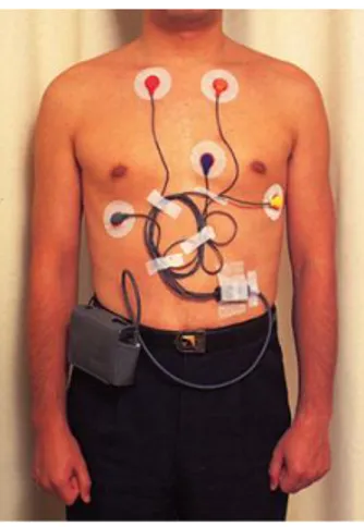 Figura 2.1: Holter Monitor: strumento di registrazione cardiaca per 24 ore