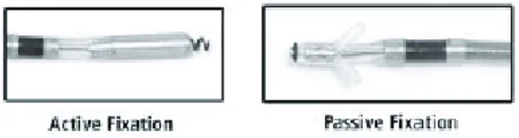 Figura 3.4: Punte degli elettrocateteri con esempi di fissaggio attivo (sn)  e passivo (dx).