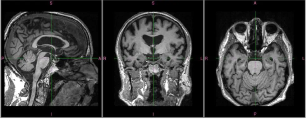 Figure 5: Example of MRI after cropping 