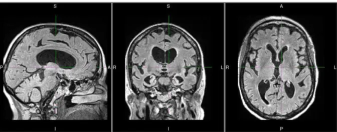 Figure 14: Example of MRI used as target 