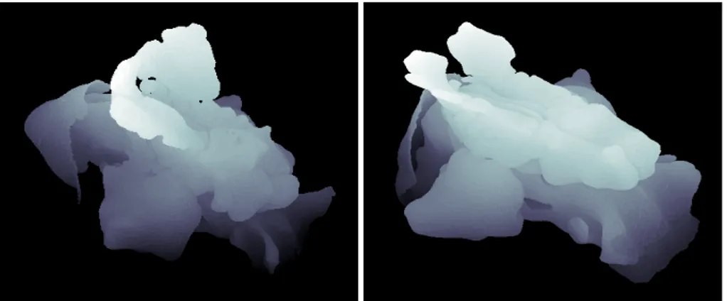 Figure 1.2: Nose bone structures complete of paranasal sinuses.