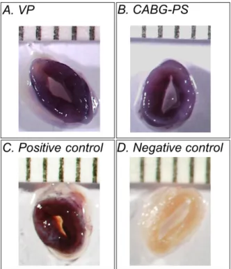 Figure 3.2. Images of SV rings stained with MTT  after  7-days  culture  in  the  EVCS  under  VP  (A),  and  CABG-PS  (B)  conditions