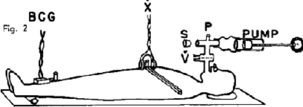 Figure  1.36:  set  up  for  measurement  of  mechanical  motion  in  response  to  a  small  pump  at  the mouth 