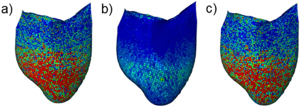 Figure 4: Stress distribution on the V side (a), mid-section (b) and A side (c) for the SH model of the AR1 LC leaflet.