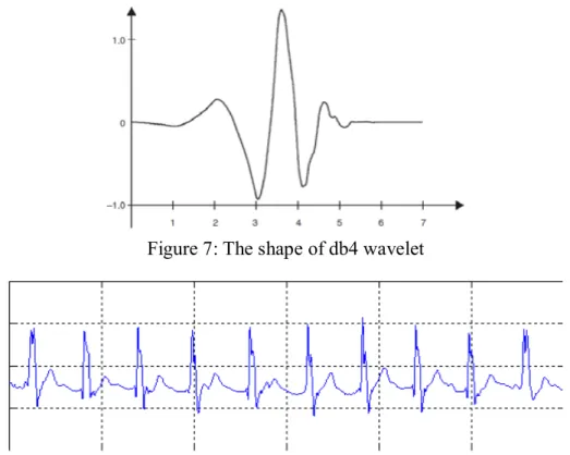 Figure 8: Approximation signals and details of the third level of ECG decomposition of  signals using db4 wavelet 