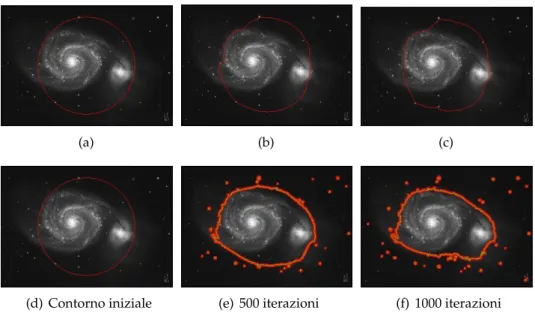 Figura 1.7: Confronto tra il metodo GAC (in alto) e quello di Chan e Vese (in basso). Immagine ottenuta con MATLAB.