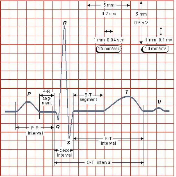 Figure 8. A typical normal ECG tracing