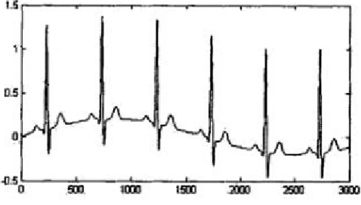 Figure 9. The ECG signal with baseline drift