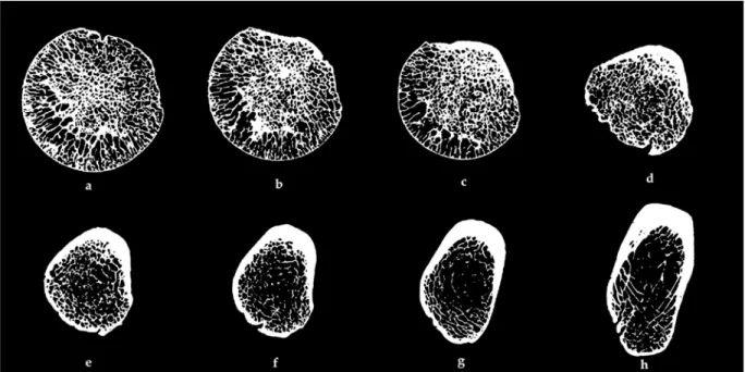 Figure 5 - Slices from a 3D µ-CT scan of a human femur bone spanning from the midsection of the femur head  to the greater trochanteric area (a-h)