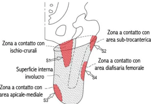 Figura 2-17. Spinte esercitate dall’invasatura sul moncone