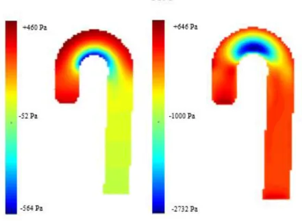 Figura 3: mappe di pressione statica su sezione sagittale dell’aorta da soluzione in Fluent convertito in  Matlab (sinistra) e Matlab (destra) al fr 1 