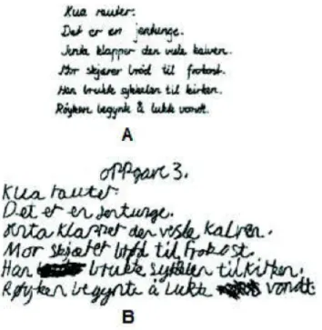 Figura 1.3: Scrittura di un bambino normale (A) messa a confronto con il testo scritto da un bambino con goffaggine e disgrafia (B).