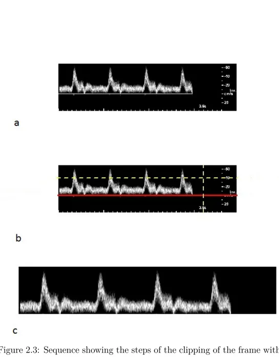 Figure 2.3: Sequence showing the steps of the clipping of the frame with the spectrum waveform