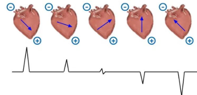 Figure 1.6: Projection of differently oriented cardiac vectors on the same lead