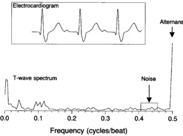 Figure 2.2: Example of spectral analysis of ECG, obtained from aligning 128 consec- consec-utive beats.
