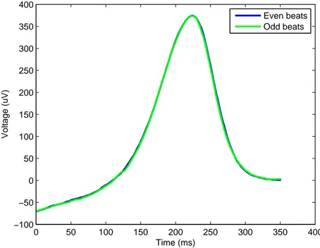 Figure 3.7: Median T-waves for even beats (blue waveform) and for odd beats (green waveform)