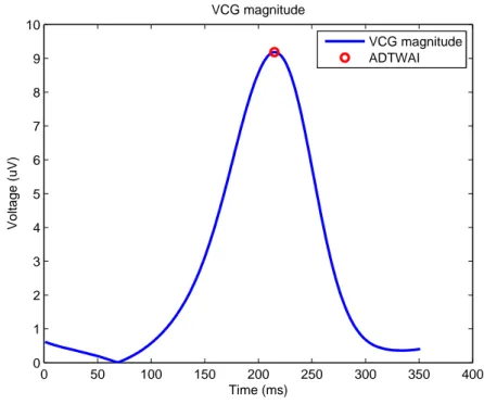 Figure 3.13: VCG magnitude and value of ADTWA recorded with VM Method (red dot).