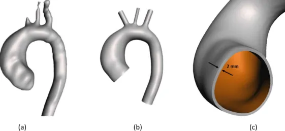 Figure 2. Figure shows MRI images where suture site is highlighted by the red arrows (a) and the STL geometry co- co-registered (b)