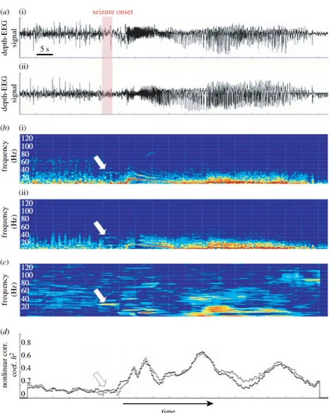 Figure 2.2: (a) Depth-EEG signals recorded from (i) amygdala (AMY) and (ii) hippocampus (HIP) in a human during transition to seizure activity in temporal lobe epilepsy
