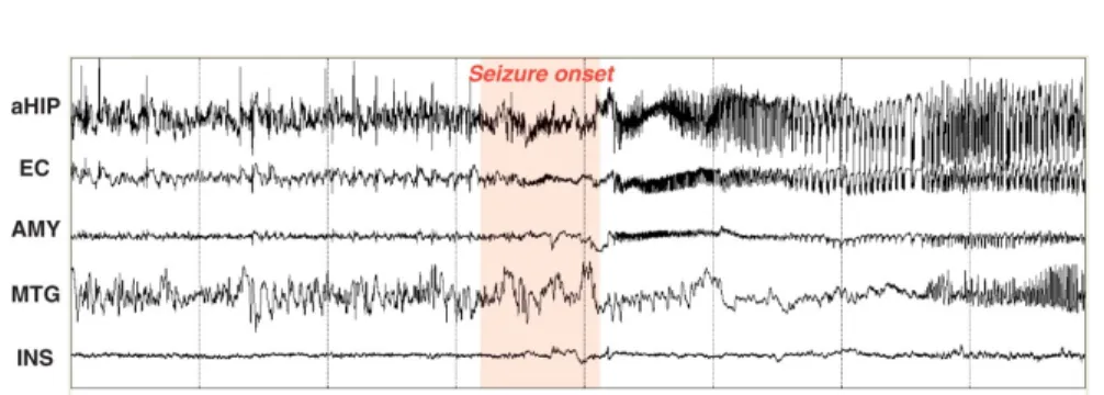 Figure 2.4: SEEG signals recorded in dierent brain cortical areas: anterior Hippocampus (aHIP), entorhinal cortex (EC), Amygdala (AMY),  MiddleTtem-poral Gyrus (MTG), Insula (INS)