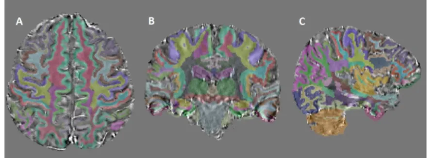 Figure 2.5: Labeled QSM Brain