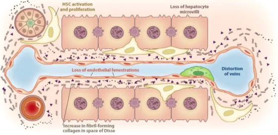 Figure 1.8 Deposition of ECM in the space of Disse leads to the loss of both endothelial fenestrations and  hepatocyte microvilli, which results in both the impairment of normal bidirectional metabolic exchange between 